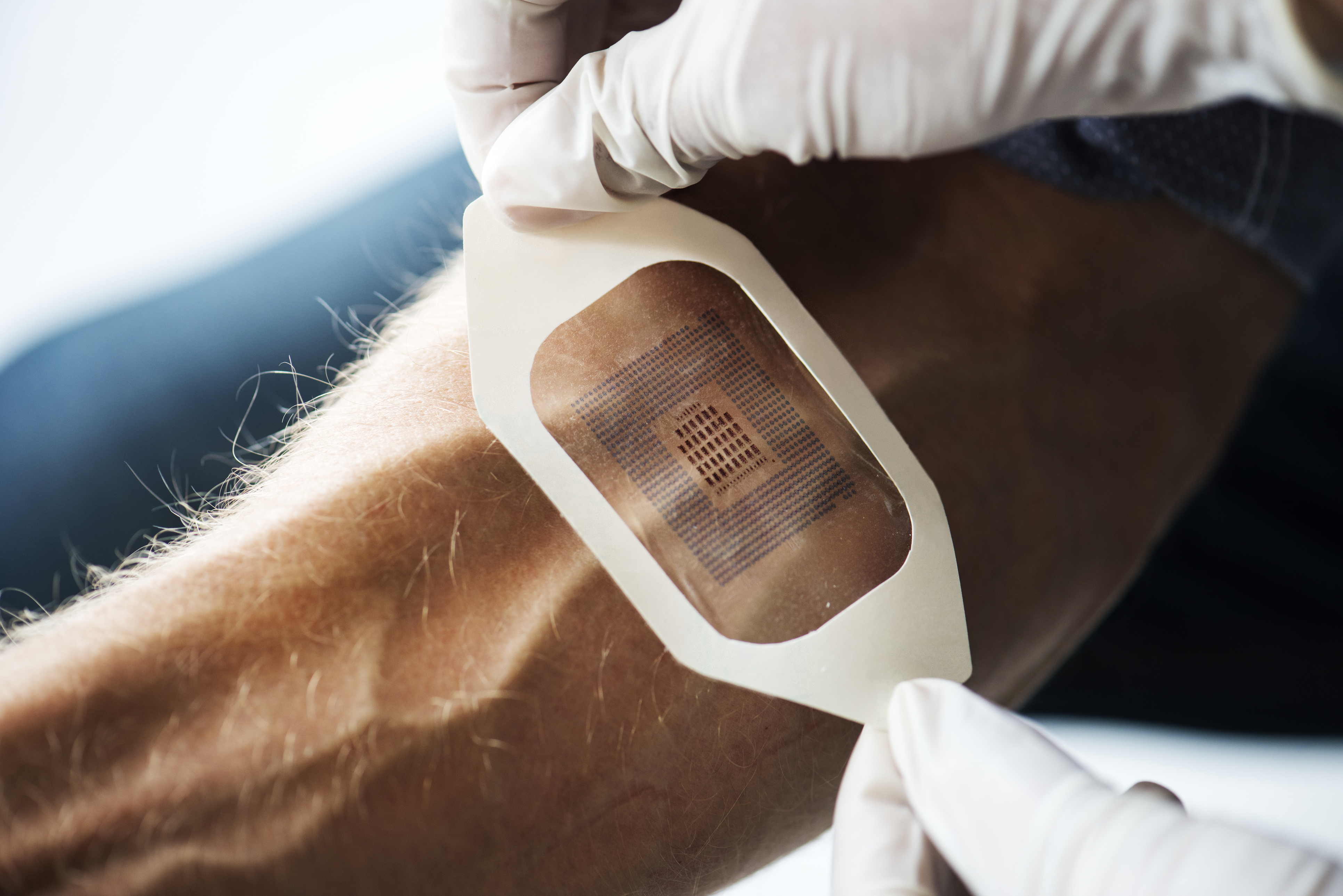 Biosensory Wearable IoMT Devices: Definitions, Applications, and Challenges}